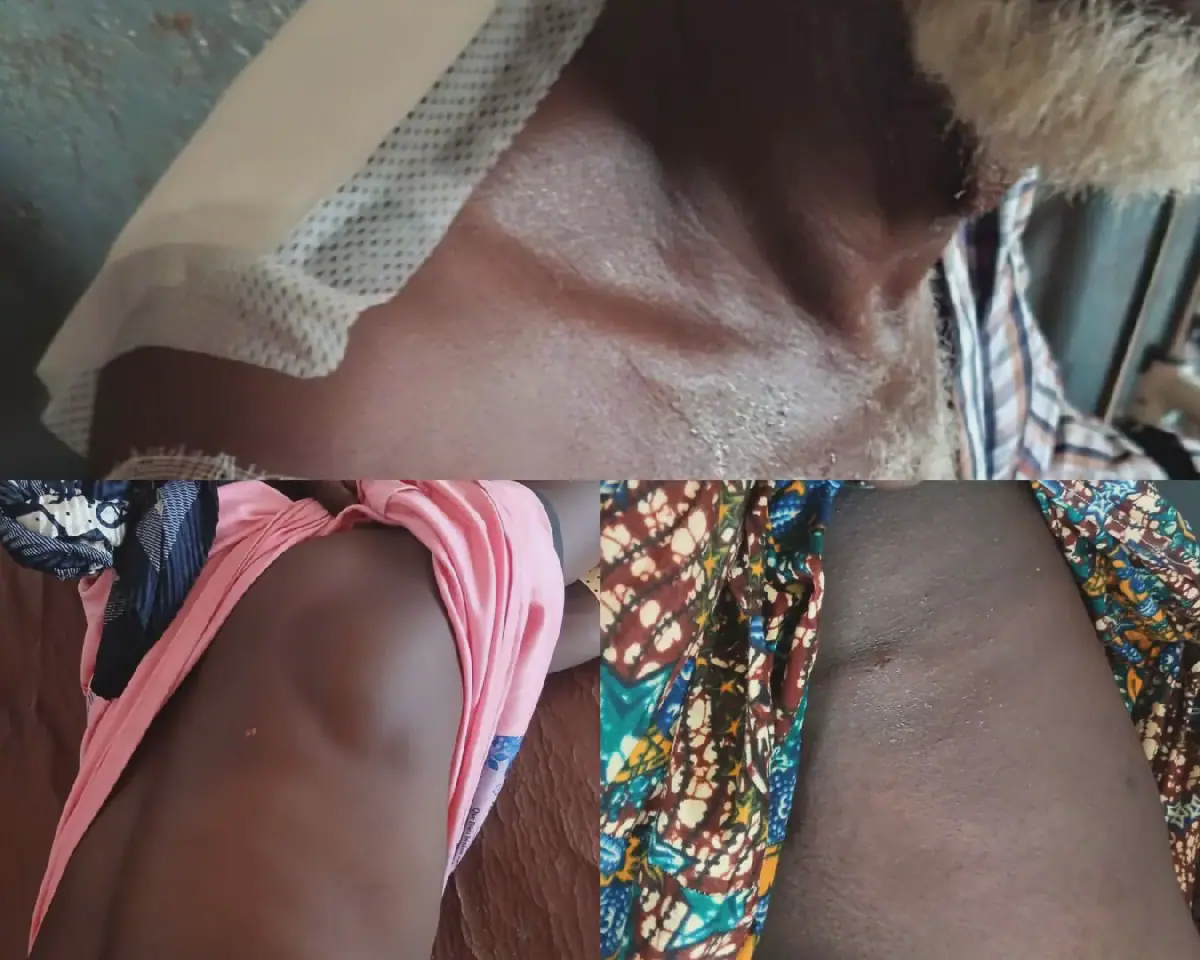 Clashes Between Two Communities in Guinea's Siguiri Region Leave Six Injured
