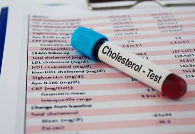 Moroccan Expert Shares 5 Simple Evening Habits to Regulate Cholesterol Levels