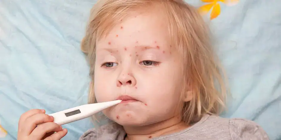 Egypt's Health Ministry Successfully Vaccinates 12 Million Children Against Measles in Four Days