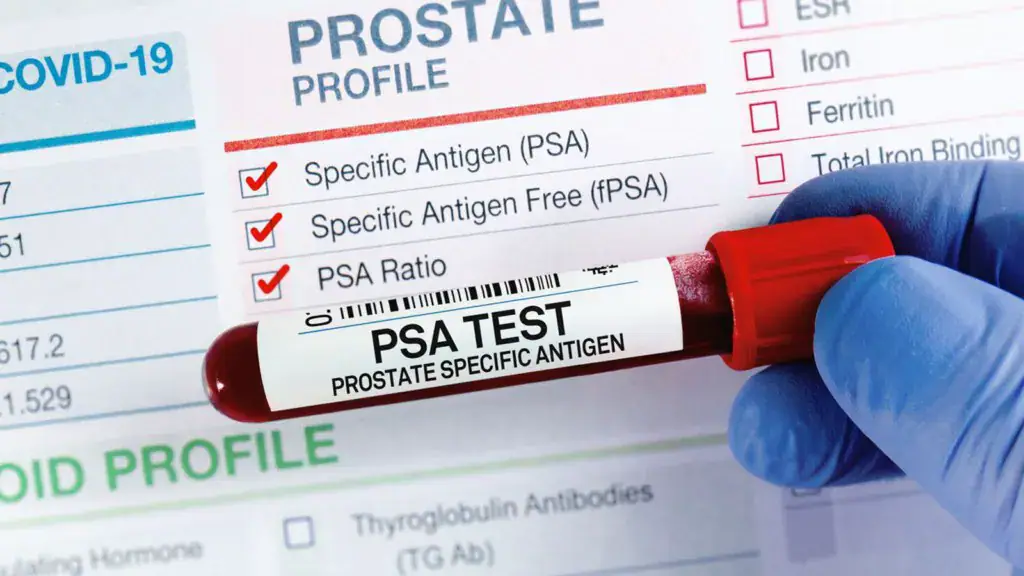 Doctor Urges Ghanaian Men to Start Prostate Cancer Screening at 40