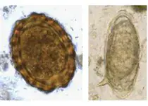 High Prevalence of Helminthiases Among Schoolchildren in Chad