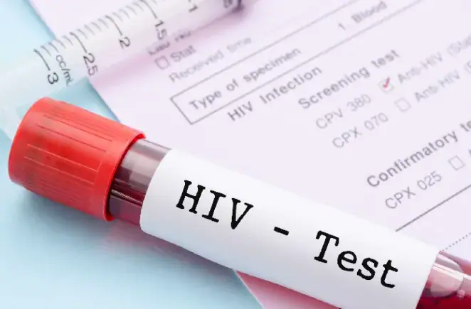 Ghana AIDS Commission Warns Against Denying HIV Patients Jobs and School Admission
