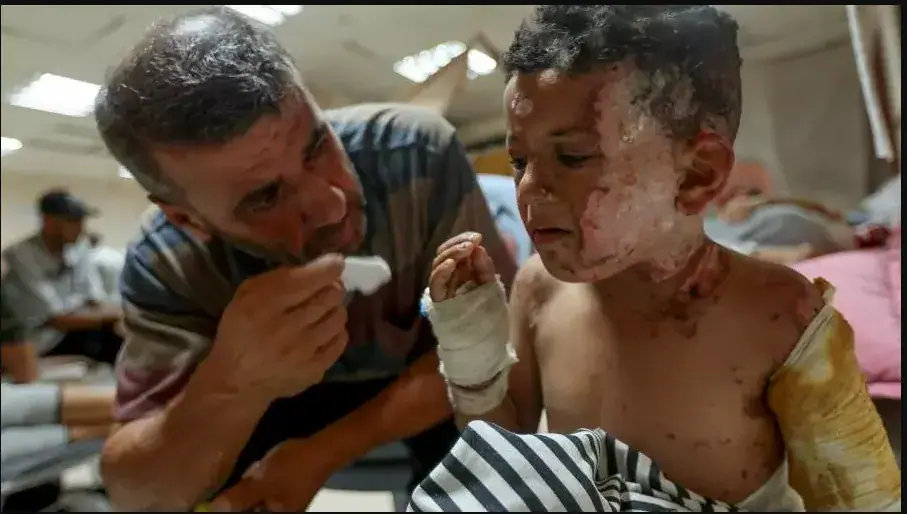 Restrictions on Medical Supplies Halt Production of Burn Treatment Masks in Gaza