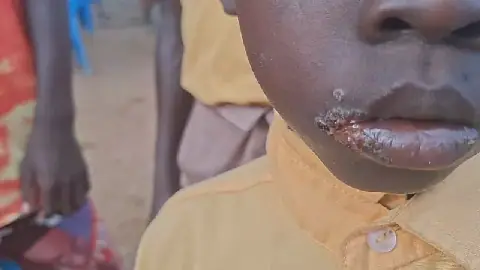 Mysterious illness affects children and adults in Ghana's Mafi Kope community