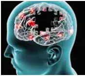 Alzheimer's Disease: A Growing Concern in Nigeria