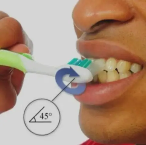 Mastering the 45-Degree Brushing Technique for Optimal Oral Health