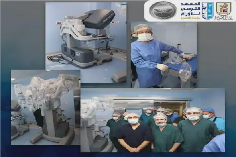 Egypt's National Cancer Institute Pioneers Robotic Thymus Gland Removal