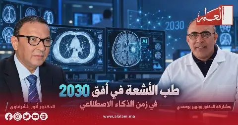 The Future of Radiology in 2030: Will Artificial Intelligence Replace Doctors?