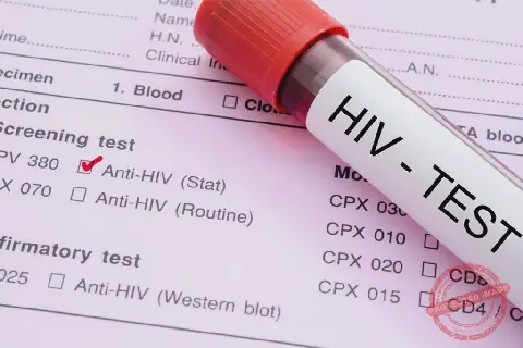 HIV specialist calls for routine testing for adults in South Sudan