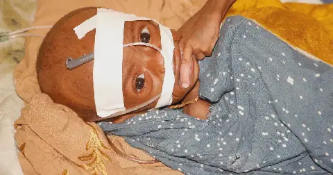 A malnourished child receives treatment at Banadir Hospital in Mogadishu, Somalia, on May 14 2025. Picture: