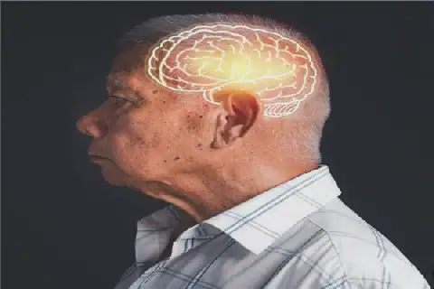 Scientists Uncover Hidden Clue to Alzheimer's Disease