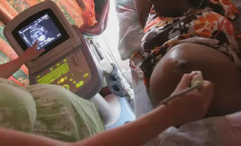 US HIV Program Cuts Disrupt Services in Africa