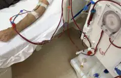 Nurses in Abidjan Struggle to Address Depression in Haemodialysis Patients