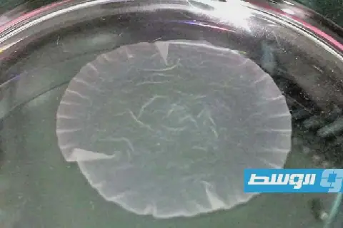 مستشفى ياباني يجري أول عملية لزراعة خلايا عضلية للقلب مأخوذة من خلايا جذعية تجارياً