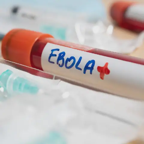 WHO Calls for Improved Access to Medical Oxygen in DRC's Ebola Response