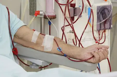 Algerian Hospital Faces Critical Staff Shortage in Dialysis Center