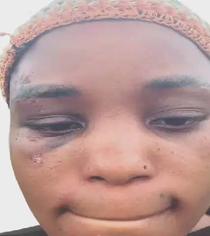 Hairstylist Recounts Ordeal After Escaping from Kidnappers