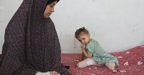 Gaza Children Face Uncertain Future After Losing Limbs in Conflict