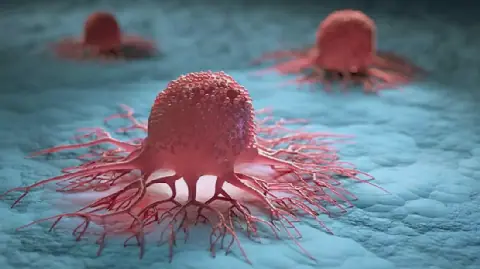 Cancer rates rising among younger people, global study finds