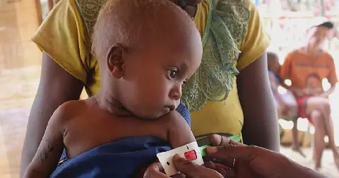 Madagascar residents gear up for impact of El Niño