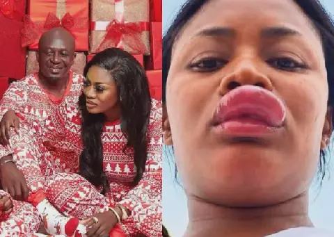 Ghanaian Fashion Influencer Nana Akua Addo Hospitalized After Alleged Assault