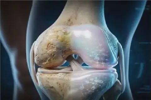 Egyptian Scientists Successfully Stimulate Joint Cartilage Growth and Treat Knee Osteoarthritis
