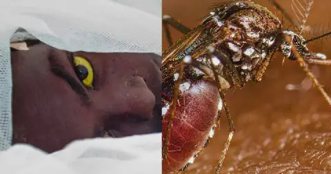 Gov’t declares Yellow fever outbreak in Upper West after 3 confirmed dead; Here's what you need to know image