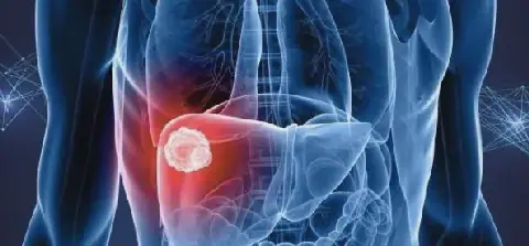 Late‑night meals linked to 20‑30% higher risk of liver disease, study finds