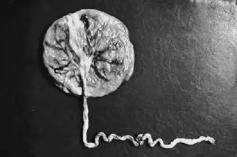 Bénin : l'enterrement du placenta, une tradition africaine à l'épreuve de l'étranger