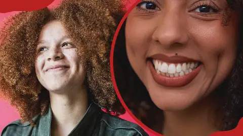 Dimples