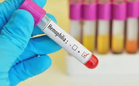 EALA pushes for regional haemophilia framework and better patient data