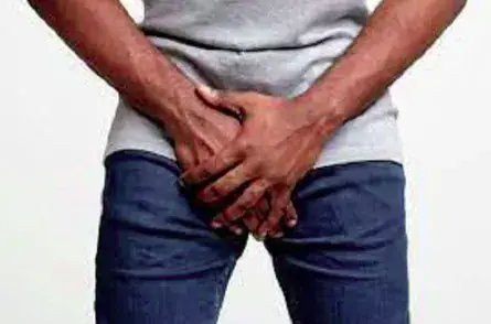 Ghana Police Dismiss 10 Cases of Alleged Missing Manhood