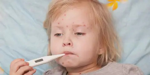 Egypt's Health Ministry Successfully Vaccinates 12 Million Children Against Measles in Four Days